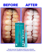 Multi-Mode Sonic Electric Toothbrush